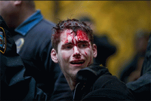 Brendan Watts - Beaten by NYPD #N17, From ImagesAttr