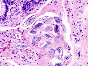 Schistosoma japonicum worm histopathology