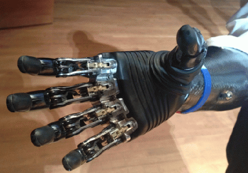 Bionic Hand