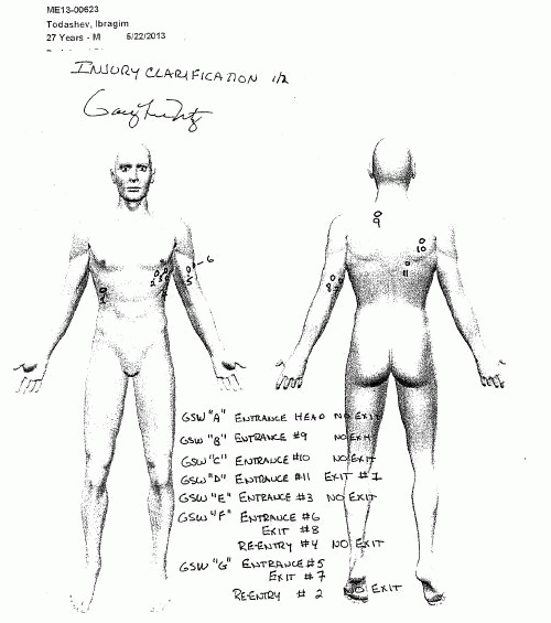 Coroner's drawing of Ibragim Todashev's wounds (, From ImagesAttr