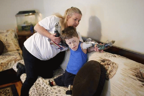 Jeremiah Mitchell, was hit with meningitis at 6. At left, his mom Michaela now helps the 10-year-old put on his prosthetic arms., From ImagesAttr