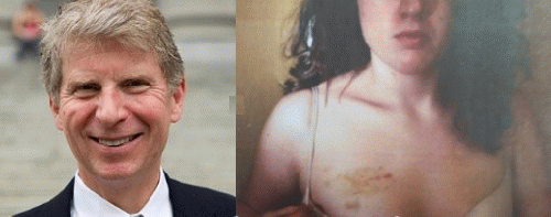 DA Vance and McMillan, showing her injury from police abuse ( DA Vance and McMillan, showing her injury from police abuse (