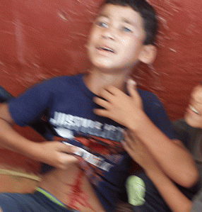 Injured Hamada Baker, taken on the terrace of the Gaza beach hotel, where he was treated., From ImagesAttr