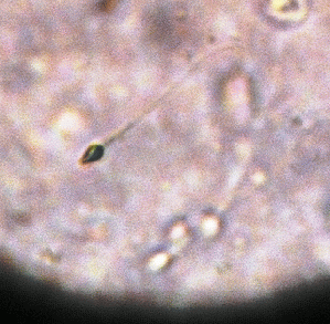 wet micrscopy sperm, From ImagesAttr