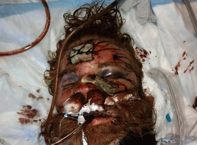Kelly Thomas was killed by police brutality., From ImagesAttr