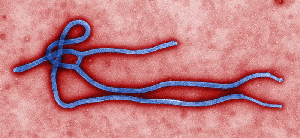 Ebola virus virion Ebola virus virion