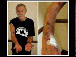 Ray McGovern Bloodied, Bruised and Arrested at Hillary Clinton Speech at George Washington University, From ImagesAttr