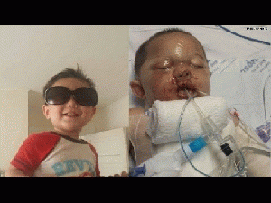 Family gives update on baby burned by SWAT team