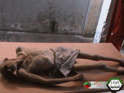 Palestinians -- and Syrians - in Yarmouk are killed in a myriad of ways, including starvation., From ImagesAttr