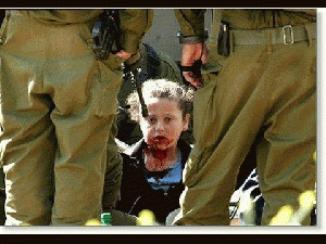 Israelis torturing non-Jewish children. Palestinian girl Nesreen Hash'hash after being shot ..., From ImagesAttr