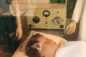 ECT Electroconvulsive Shock Therapy