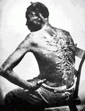 A photograph showing the whipping scars on the back of an African-American slave., From ImagesAttr