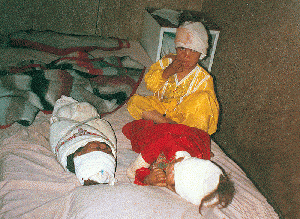 Three children wounded by a US bomb in Nangrahar province of Afghanistan.
Their parents were both killed., From WikimediaPhotos