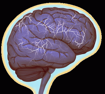 A hyperactive brain. A matching .gif depicting a normal brain is available upon request. Credit: Anita Impagliazzo / UVA School of Medicine