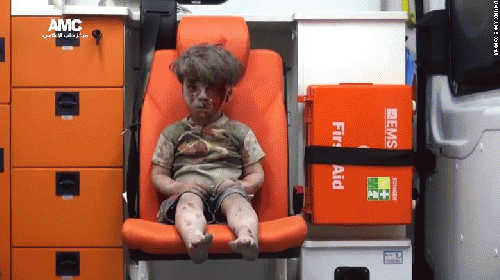 The bloodied boy in Syria, From ImagesAttr