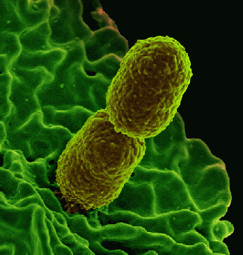 Klebsiella pneumonia Bacterium