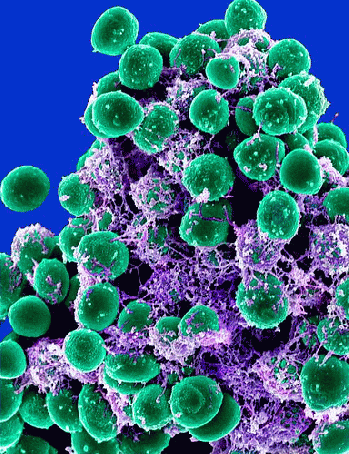 Staphylococcus epidermidis Bacteria, From FlickrPhotos