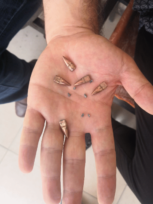 Deadly Bullets shot by IDF, From Uploaded