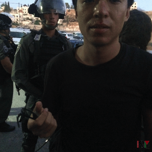 Edmond Sichrovsky with broken glasses and a cut on the lip after he was repeatedly kicked in the face by Israeli riot police while non-violently resisting the demolition of Palestinian homes in Wadi al-Hummus on July 22.
