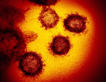 From flickr.com: Novel Coronavirus SARS-CoV-2  