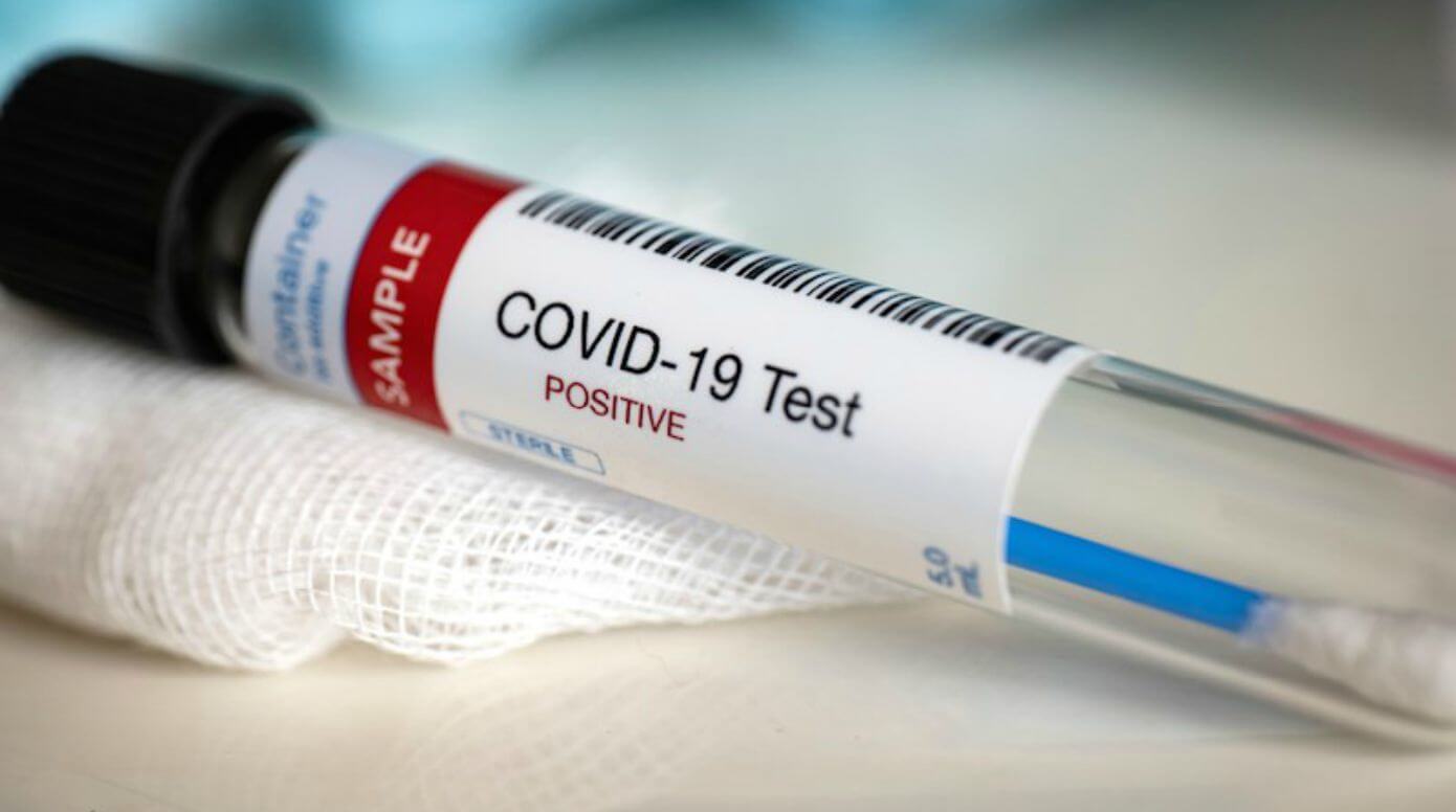 COVID test vial, From InText