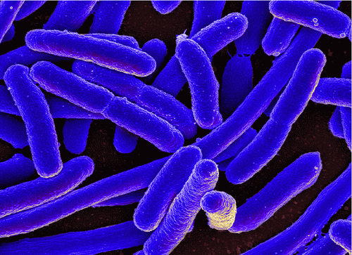 Figure 2. E. Coli infectious disease