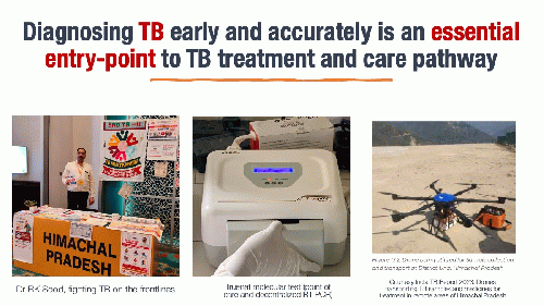 Weakest link in TB response is early and accurate diagnosis of all, From Uploaded