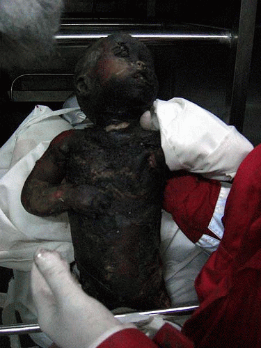 A Palestinian baby killed by Israeli military forces in the 2008-2009 Israeli invasion of Gaza., From Uploaded