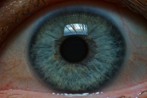 Eye